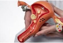 Photo of हिमाचल में Cervical Cancer का खतरा बढ़ा, 35–55 साल की महिलाएं सबसे ज्यादा प्रभावित